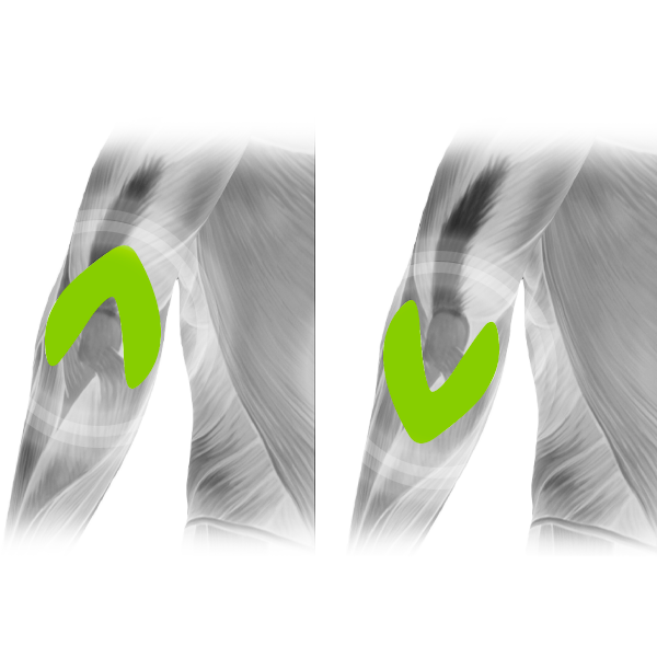 Fit therapy cerotto gomito 2 pezzi